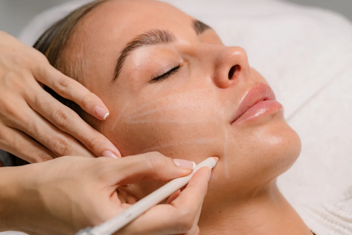 Collagen stimulator treatment in Bali at Anaya Aesthetics