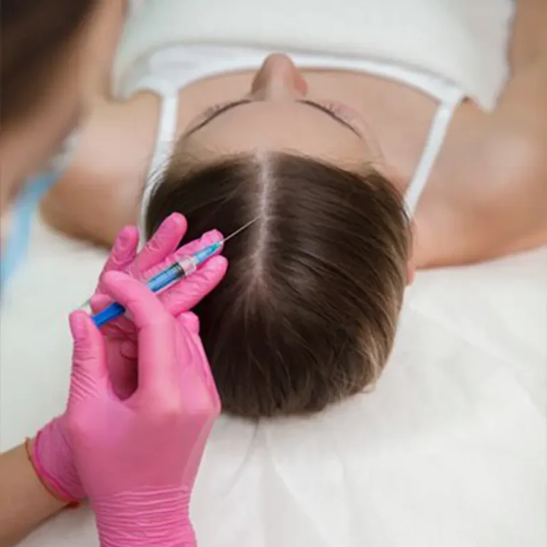 women having prp platelet rich plasma treatment in Anaya Aesthetics best beauty clinic in Bali