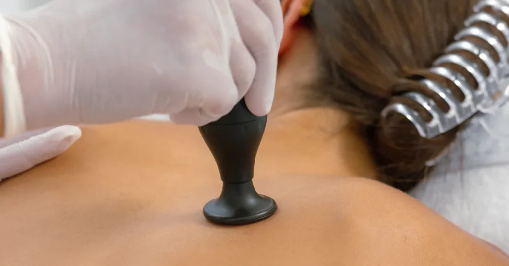 Conquering Bacne: A Practical Guide to Clearer Back Skin