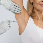 A gloved medical professional administers a syringe injection into the underarm of a smiling woman wearing a white tank top, demonstrating the procedure for botox for excessive sweating.