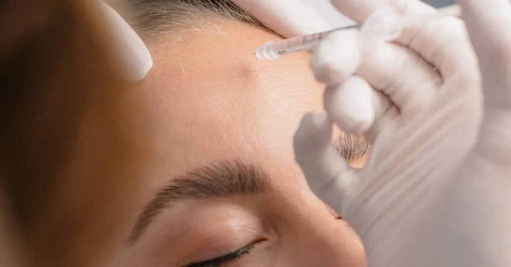 The Real Benefits of Botox: Why the Best Botox in Bali Looks Natural, Not Frozen
