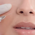 Skinboosters for Dehydrated, Dull Skin: Why Topical Skincare Isn't Enough