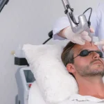 Pico Laser Treatments: The Cutting-Edge Solution for Skin Rejuvenation