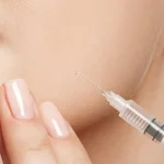 Profhilo's Path to Youthful Skin at Anaya Aesthetics