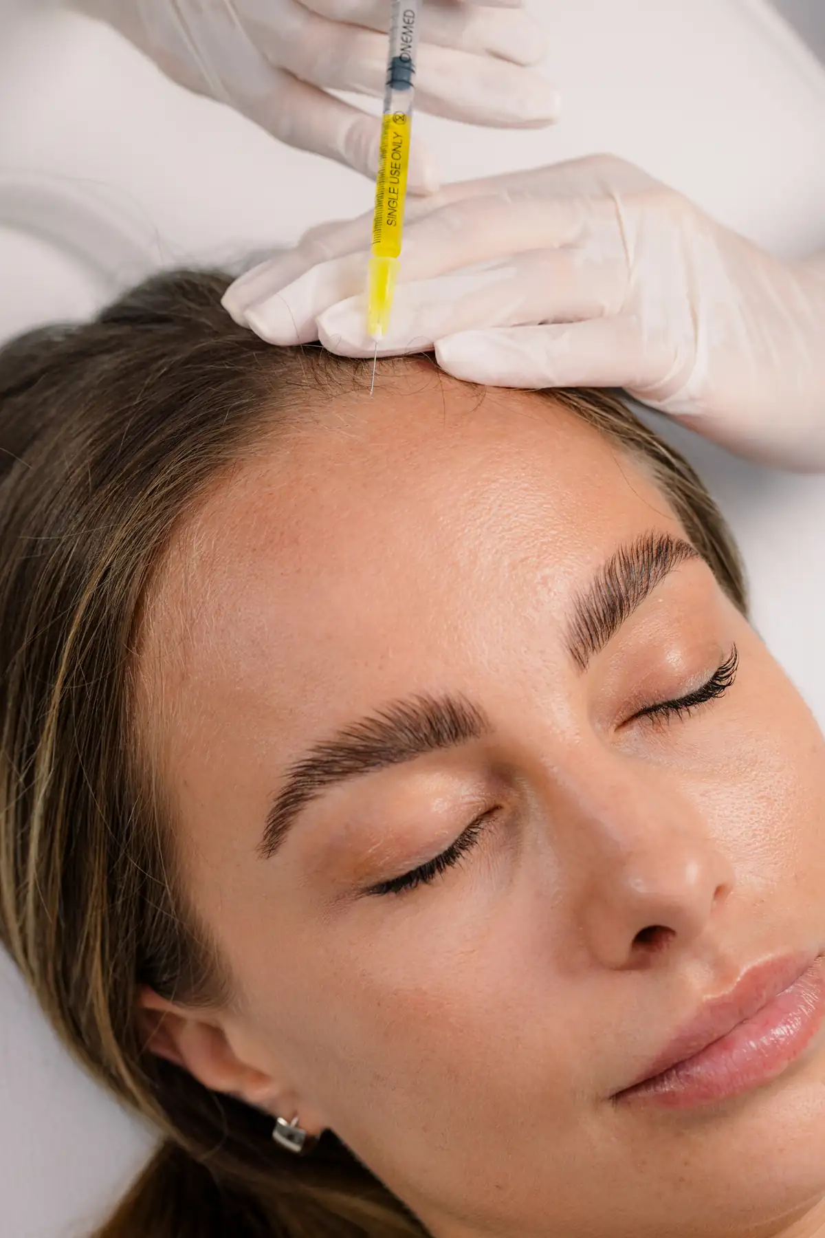 PRP (Platelet Rich Plasma) at Anaya Aesthetics Bali