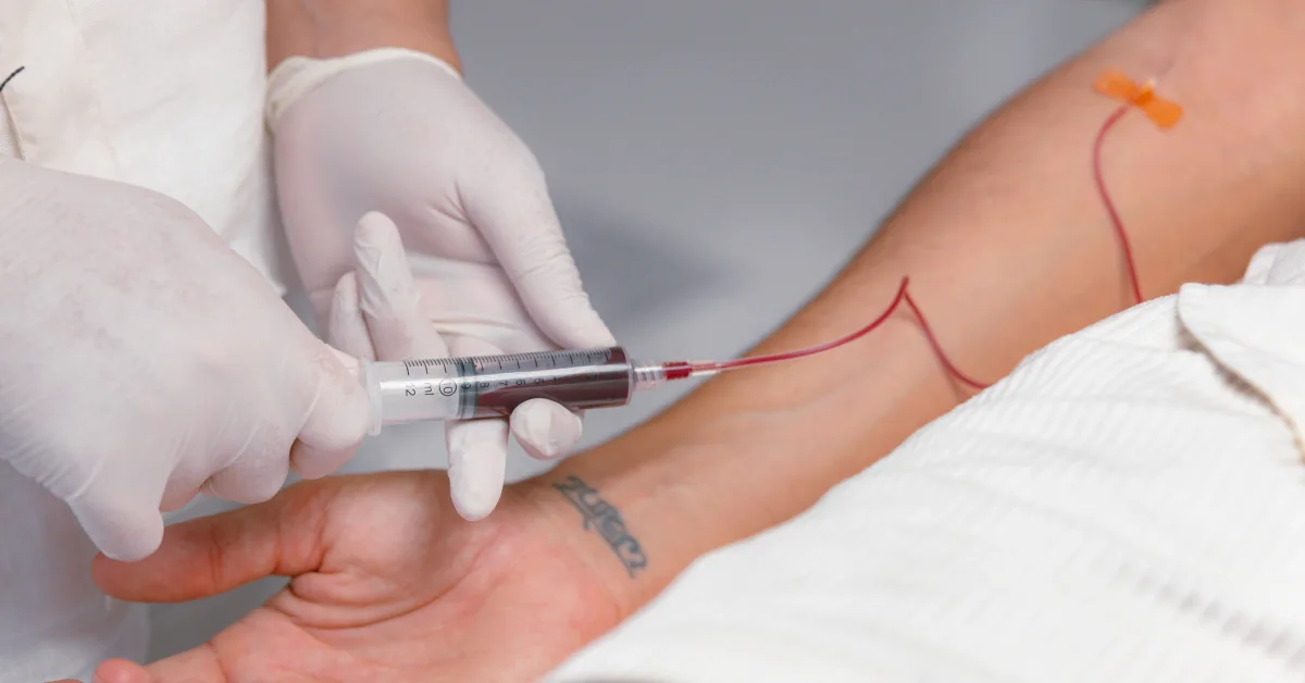 PRP: Platelet-Rich Plasma (PRP) Therapy, Harnessing the Healing Power of Your Blood