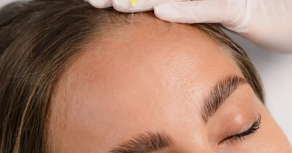 Rejuvenate and Restore with PRP Treatment