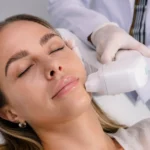 Revitalizing Radiance: HIFU Skin Tightening at Anaya Aesthetics Bali
