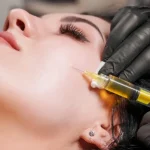 Revive Your Glow with PRP Treatments at Anaya Aesthetics