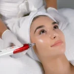 A woman looking upward while undergoing a cosmetic pen facial treatment administered by a skincare specialist at a beauty clinic bali.