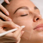 A close-up of a practitioner using a white pencil to mark a woman's face prior to a cosmetic procedure at a beauty clinic Bali.