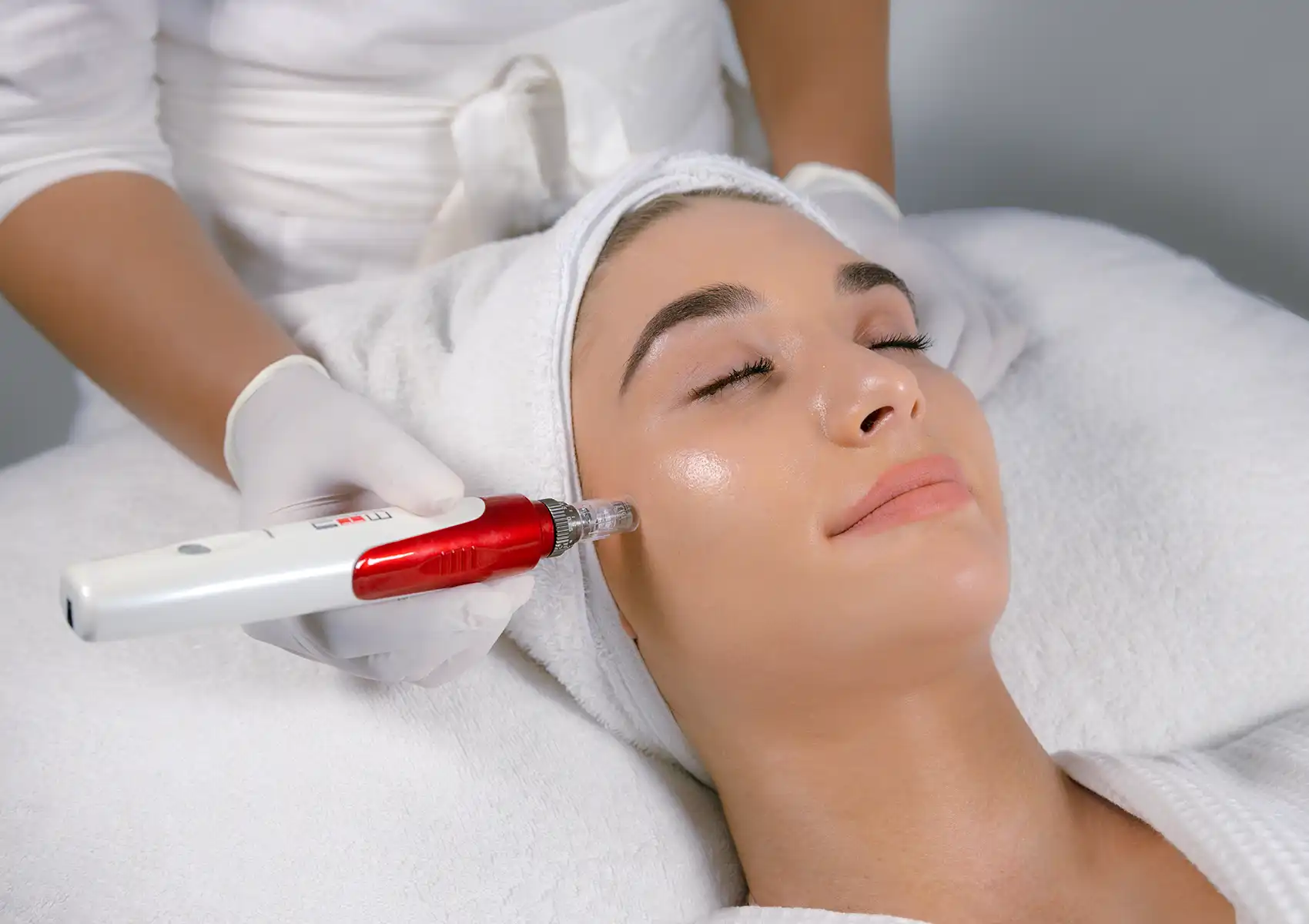 A woman with her eyes closed receiving a facial microneedling treatment from a gloved professional at a beauty clinic bali.