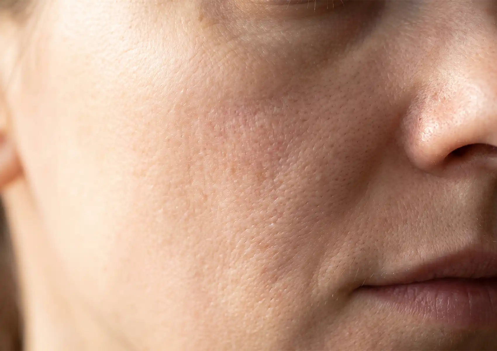 Close-up of a person's cheek and nose, showing natural skin texture and pores, representing common skin concerns addressed at a beauty clinic bali.