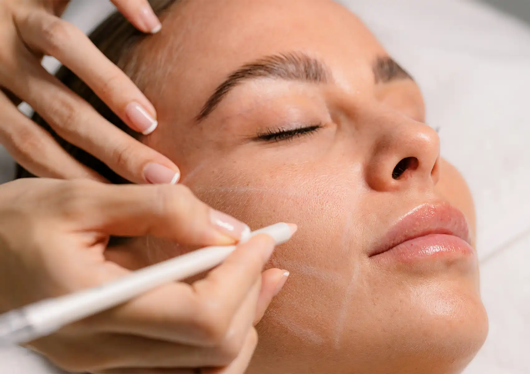 A close-up of a practitioner using a white pencil to mark a woman's face prior to a cosmetic procedure at a beauty clinic Bali.